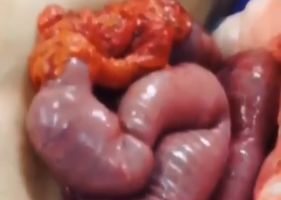 Intestines moving even outside the human body.