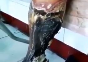 Leg completely rotten in a state of putrefaction.