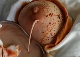 Removing disgusting thing from the woman’s breasts.