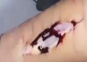 Boy cutting his own arm in self-harm session.