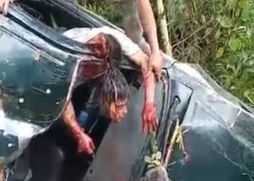 Driver with his face cut in half in a traffic accident.
