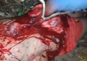 Man having his chest and belly cut opened with a knife while still alive in a brutal execution by rival criminal faction in Brazil.