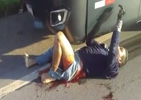 Man is run over by a bus and waits patiently for help lying on the ground with his leg and part of his buttocks all destroyed.