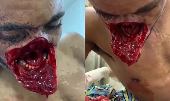 Man has his half face slashed with machete blows Photo 0001 Video Thumb