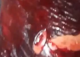 Man is stabbed in the belly and left bleeding in the ground in Brazil.