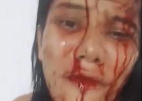 Woman all bloodied after being attacked in Brazil asking for help.