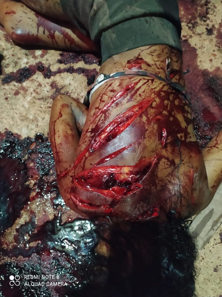 A woman with mental problems is killed in cold blood in Brazil Photo 0001