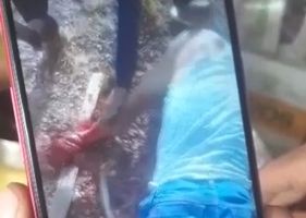 Man get his left hand ripped off with machete blows for allegedly stealing in neighborhood in Brazil.