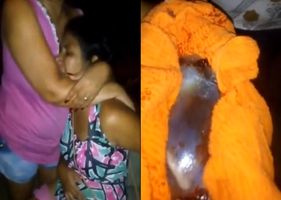 A woman gives birth unexpectedly and the fetus falls to the ground without breaking the placenta in Brazil.