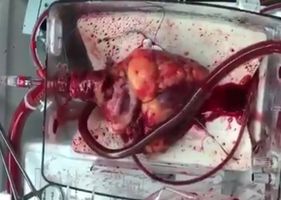 Amazing heart beating outside the human body.