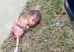 Half of a fetus is found lying on grass in Brazil.