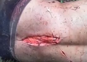 Man suffers machete blows that leave his back completely open.