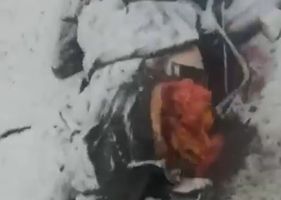 Alleged Russian soldier with his ass blown up by a missile strike.