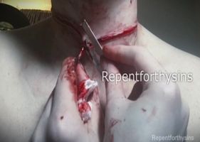 Guy cut his own throat.