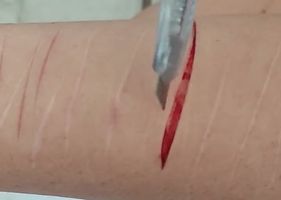 Cutting my arm.