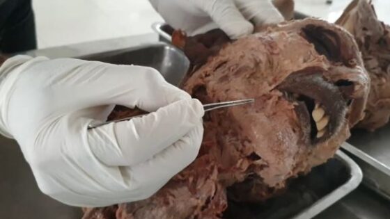 Anatomy head and neck structures identification video published on social media and went viral Photo 0001 Video Thumb