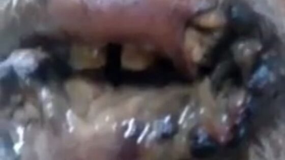The most rotten disgusting mouth of disease you will probably see in your entire life Photo 0001 Video Thumb