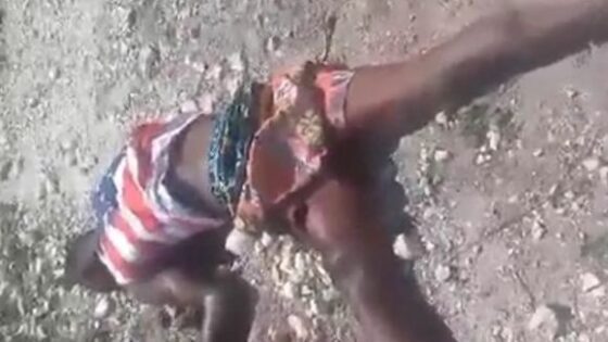 Extremely thin man is killed in haiti and left in a position of putrefaction Photo 0001 Video Thumb