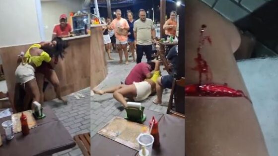 Fight between women in a bar in brazil ends with one of them having her legs cut off because her opponent had a hidden razor Photo 0001 Video Thumb