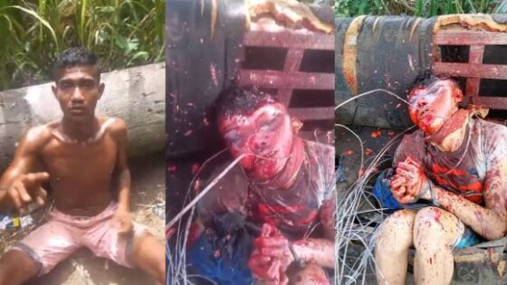 Man dies after having his head flattened during torture in brazil Photo 0001 Video Thumb