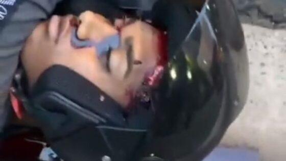 Motorcyclist is shot in the head in brazil and is left in agony in pain Photo 0001 Video Thumb