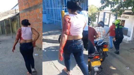 Seriously injured wife walking down the street allegedly trying to defend her husband who was arrested for stabbing her can anyone understand Photo 0001 Video Thumb